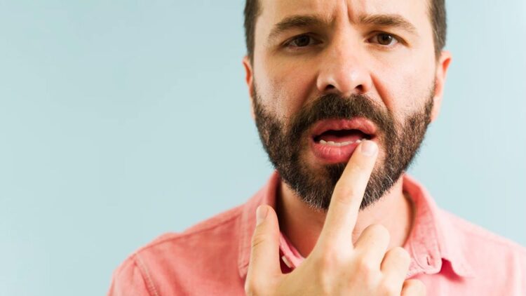 Bearded man in pink shirt pointing to dry lips and mouth discomfort caused by dehydration from cannabis edible consumption